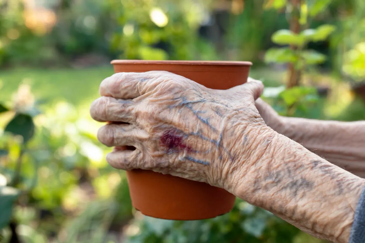 Close-up of an older man's hands with thin, translucent skin and visible veins